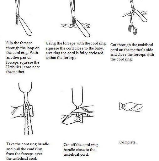hoe gebruik je een cord ring